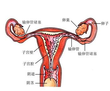 女性朋友如何对待输卵管粘连